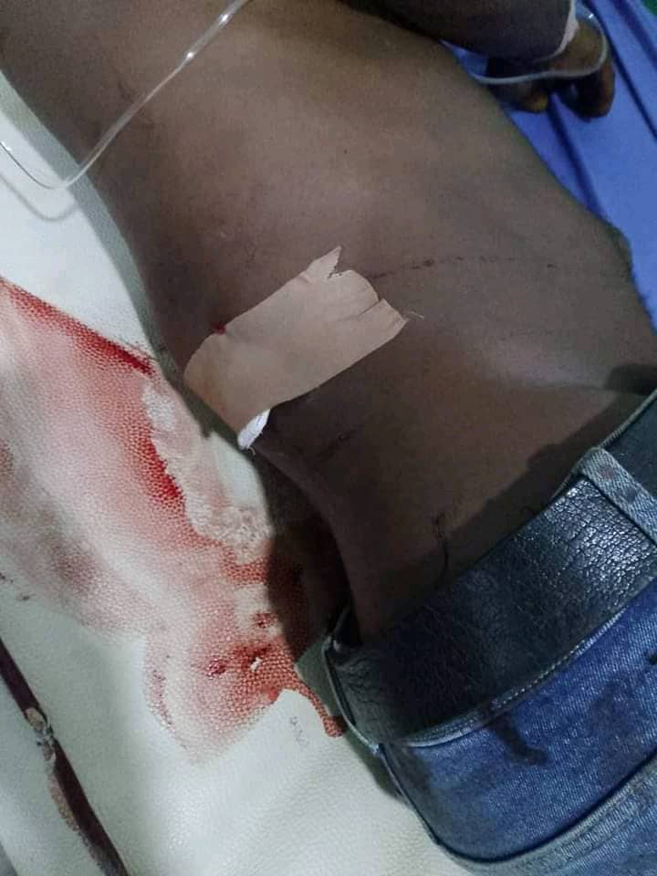 Abuja raid attack: 3 NDLEA officers sustain gunshot injuries, hospitalized